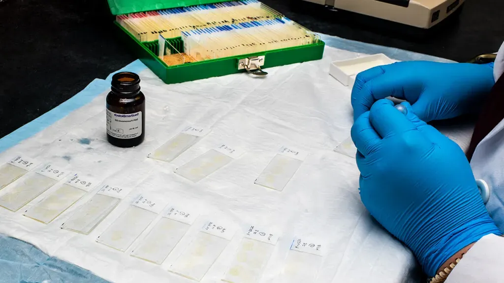 A close-up of hands preparing a row of slides for the microscope